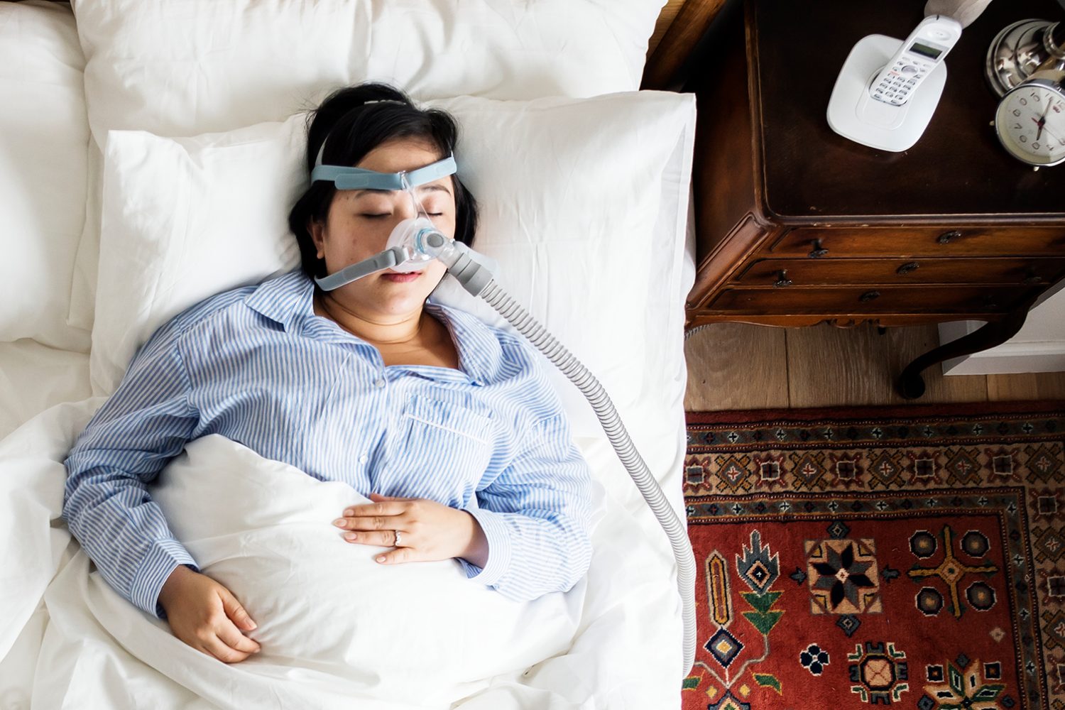 sleep apnea